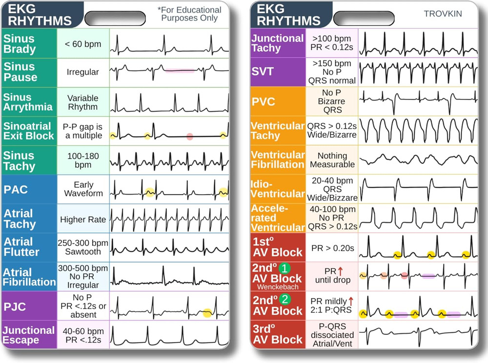 EKG Rhythm Interpretation Badge Card - Durable Waterproof Nursing Reference