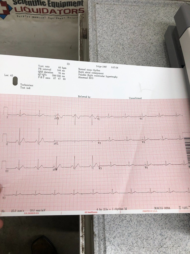 GE MAC 5500 Resting Diagnostic Interpretive ECG
