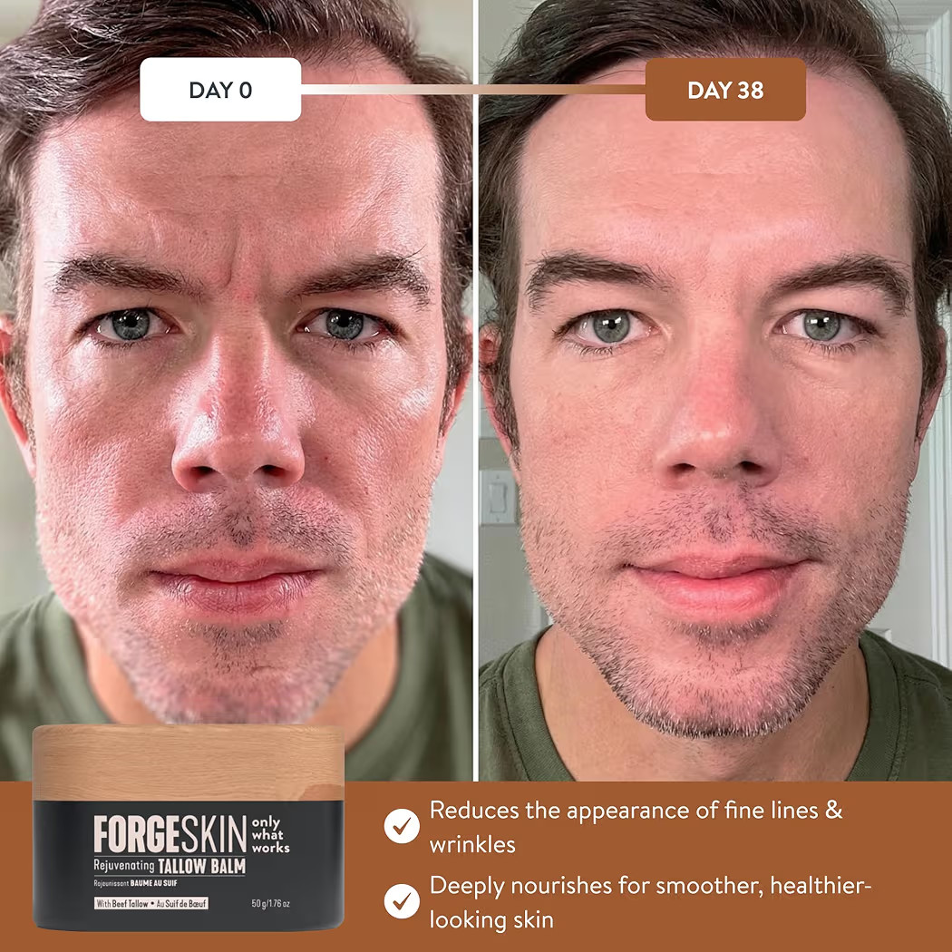 Forge Skin Beef Tallow Balm Anti-Aging Moisturizer & Hydrating Skin Cream 1.7oz