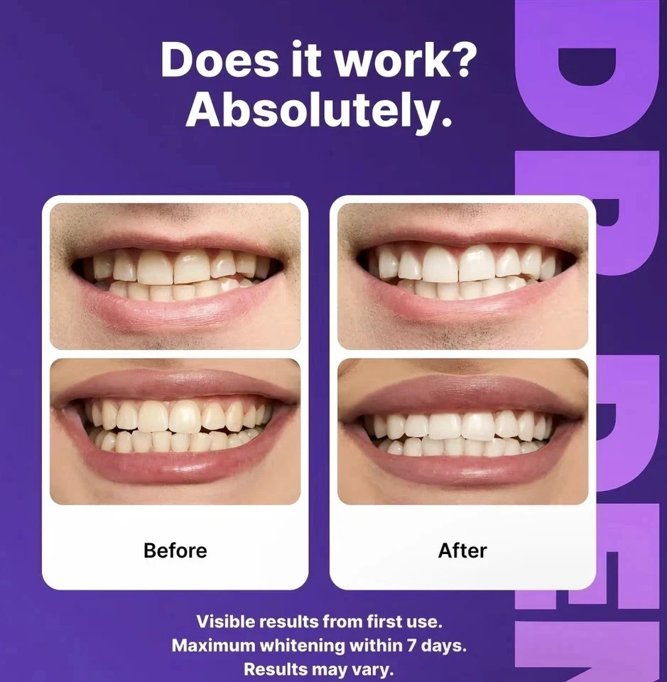 DR.DENT Purple Teeth Whitening Strips – Peroxide Free, 14 Count