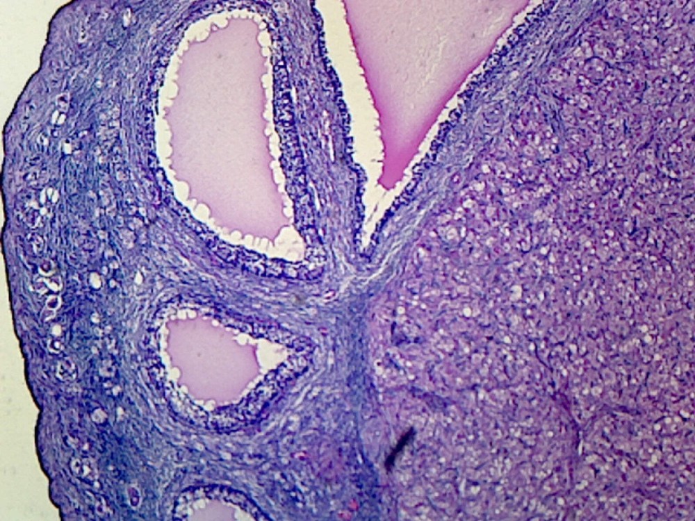 Corpus Luteum, Mammalian; Section
