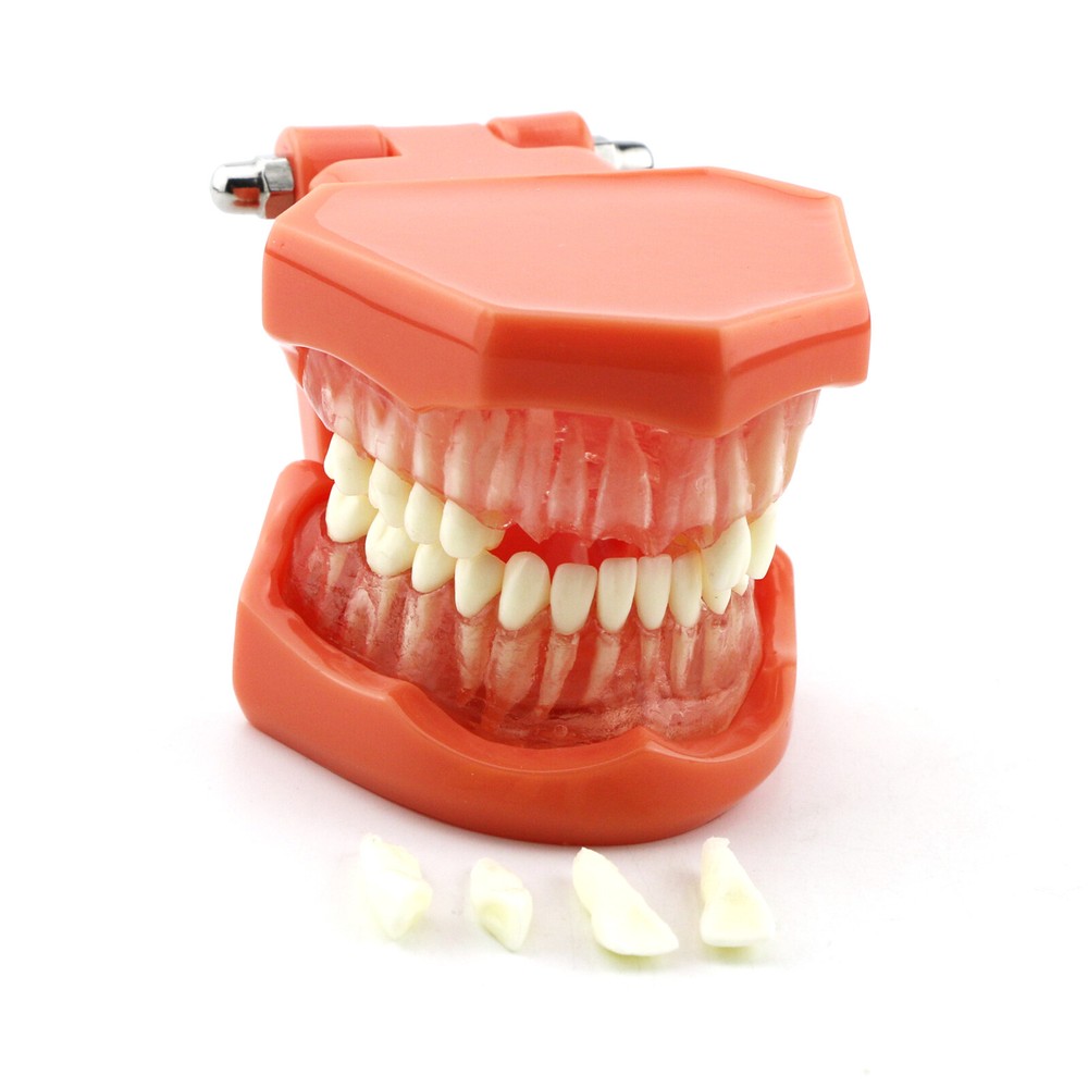 Multi Types Dental Typodont Teeth Model Implant Pathological Perio Practice Demo