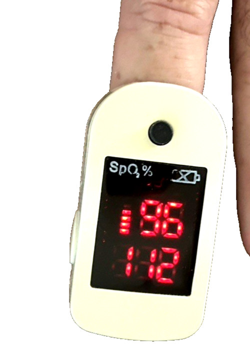 Zac Urate Pulse Oximeter model 300C Previously owned