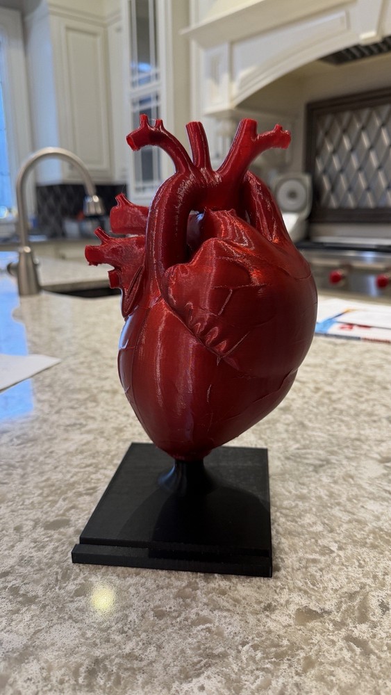 3D printed Anatomical Heart model