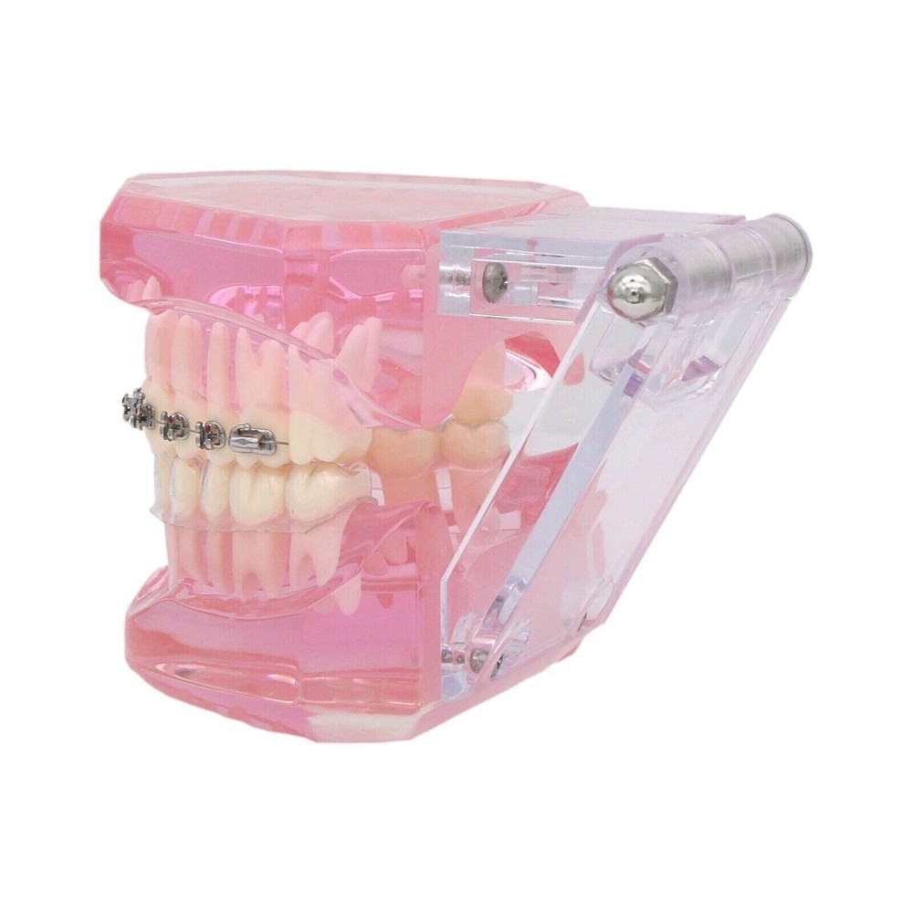 Dental Typodont Model Self-ligating Metal Bracket Ceramic Transparent Retainer