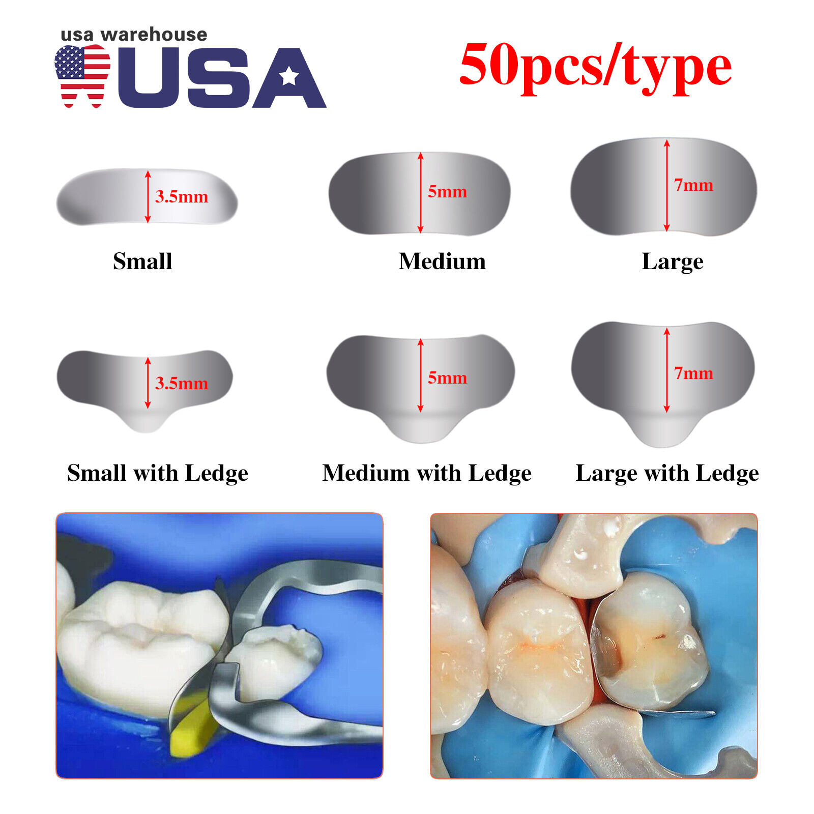 50 Pcs Dental Metal Matrices Matrix Band Sectional Contoured Refill S/M/L 35μm