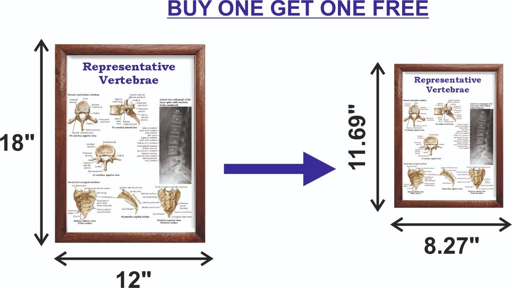 Representative Vertebrae Chart 12x18 inches