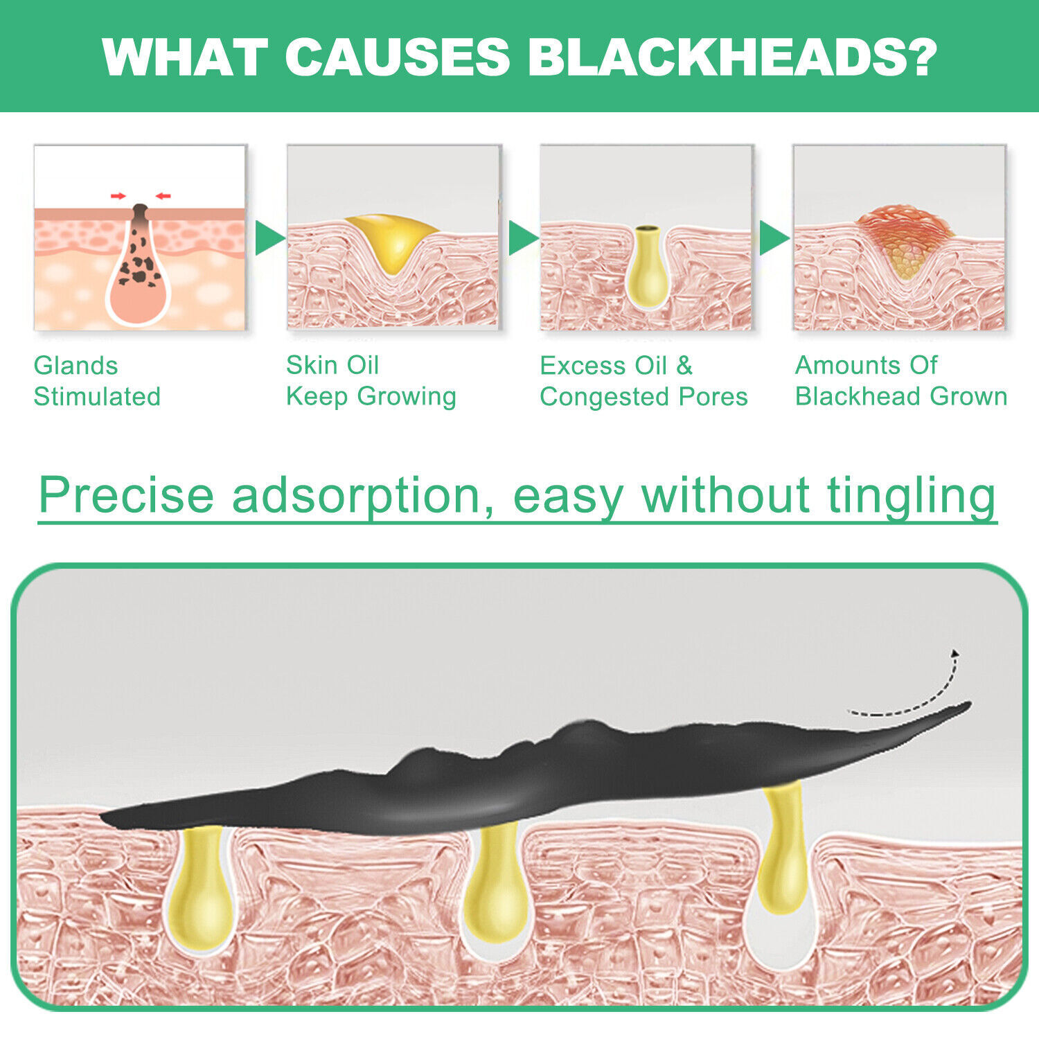 Purifying Acne Peel-off Mask ​Facial Cleansing Blackhead Remover Charcoal Mask