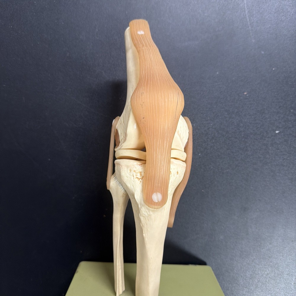 Somso NS50 Functional Knee Joint with Ligaments Anatomical Model NS 50