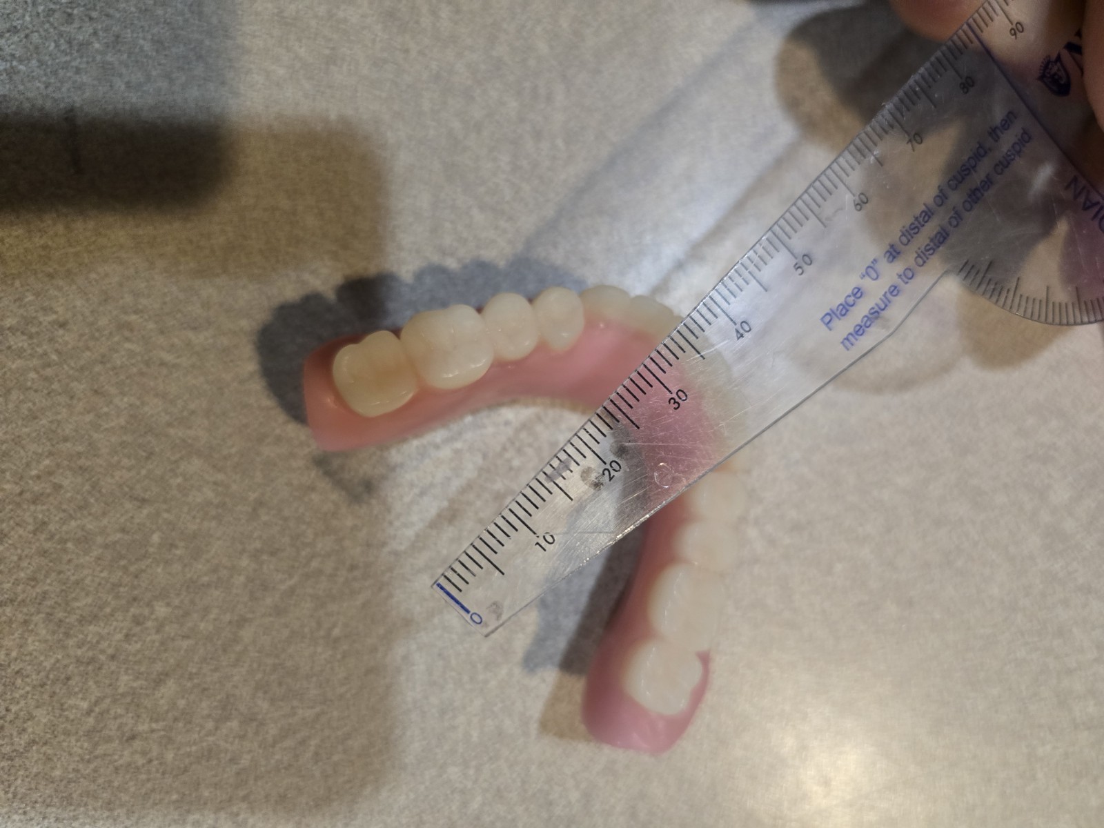 🦷1 One Set of 3D Printed adult dentures 🦷PLEASE READ