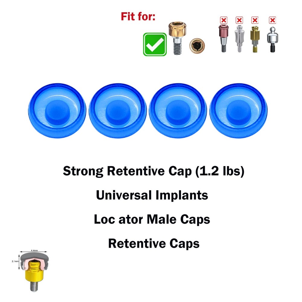 US Dental Overdenture Locator Abutment Retention Male Cap Processing Inserts Set