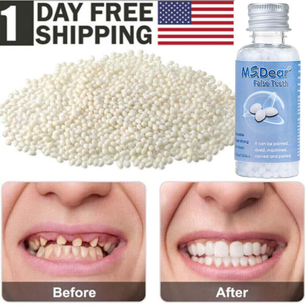False Teeth Solid Glue Temporary Tooth Repair Moldable Fix Broke Gap Teeth 30ML