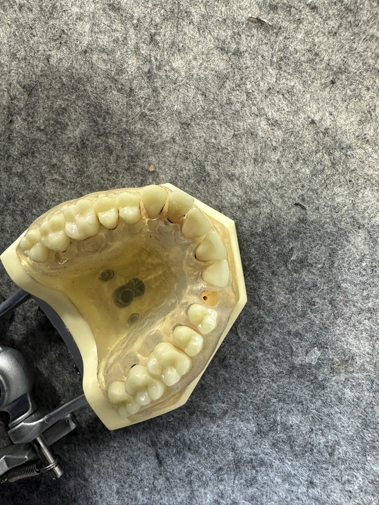 Perio Trainer Dental Model with Hinge Clear Composite gums