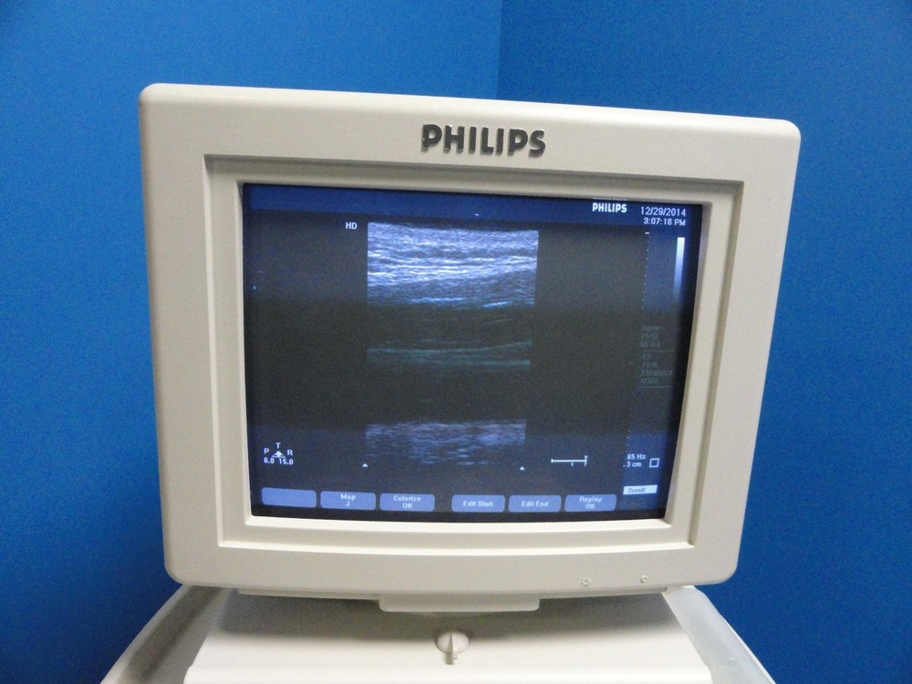 Philips HP 15‑6L Compact Linear Array Transducer – For HP 5500 & EnVisor ~ 8452