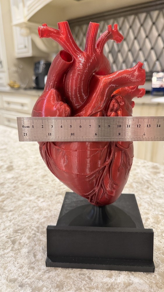 3D printed Anatomical Heart model