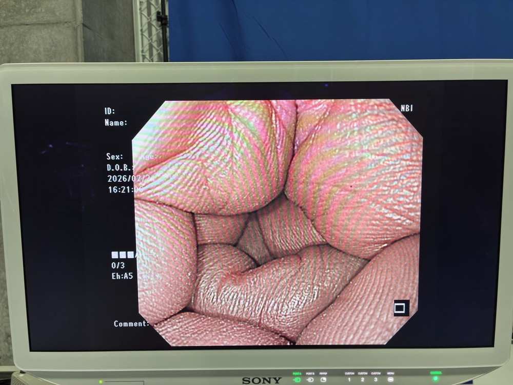 Fujifilm EG-6400N Gastroscope