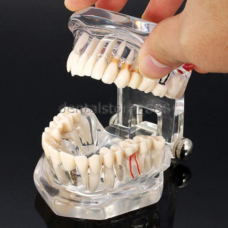 3D Human Teeth Gums Model Dentist Training Teaching Education