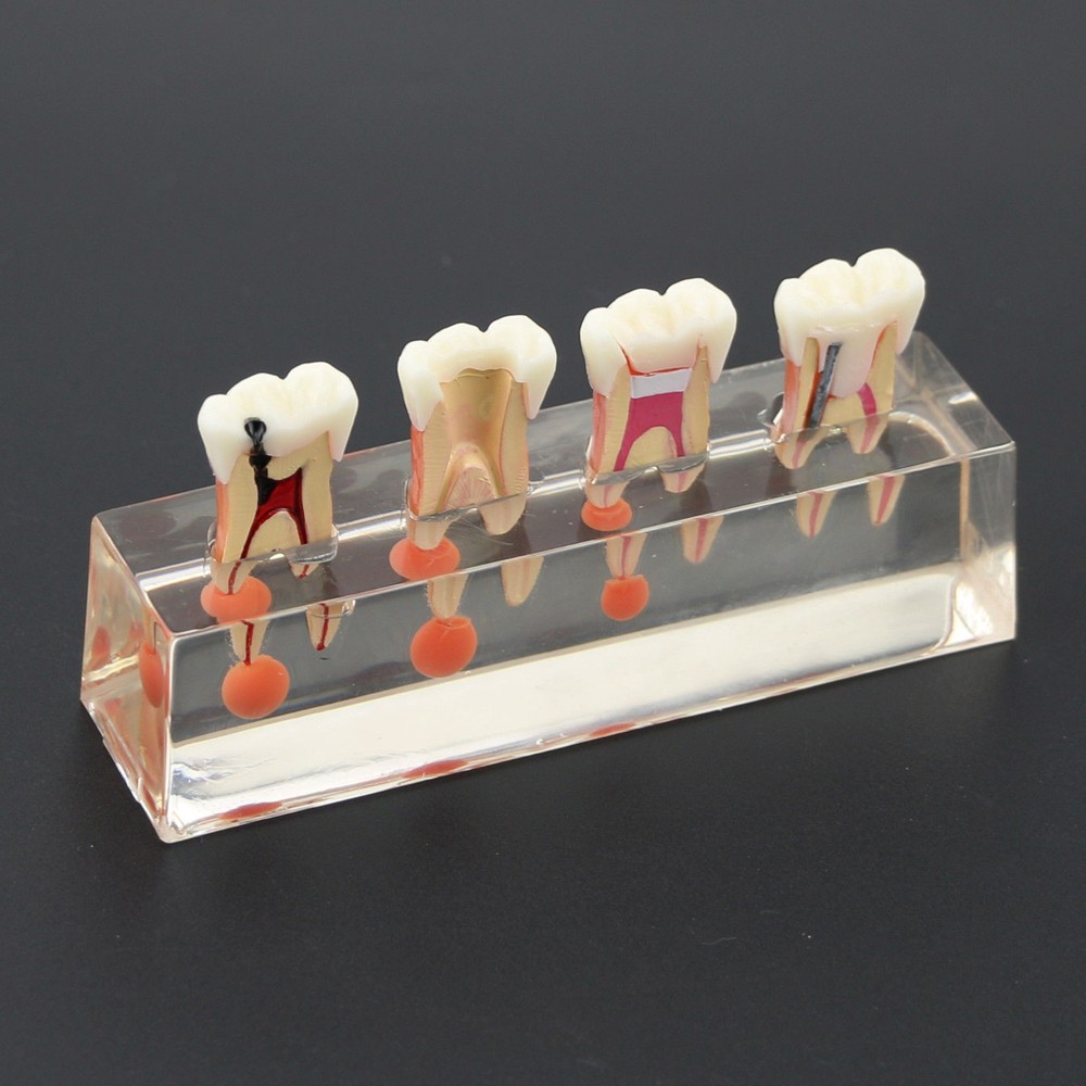 Dental Teeth Demonstrate Model #4018 Root Canal 4Stage Study Teaching Instrument