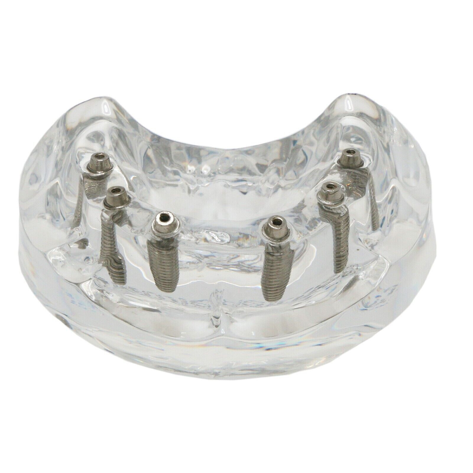 Dental All-On-6 Overdenture Implant Model Demo Upper Jaw 6 Screws Clear M6001-2