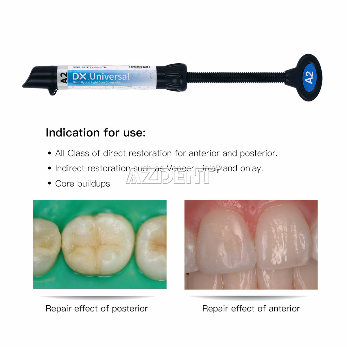 Dental Universal Light Cure Composite Resin A2 /Etching Gel/Bonding Adhesive Kit