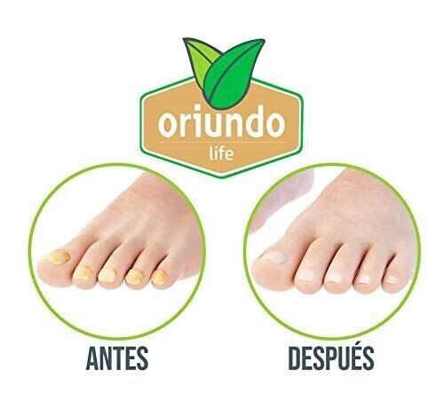 ORIUNDO Natural Life / Nail Fungus Away (Quita Hongos para Uñas) 0.5 Oz New USA