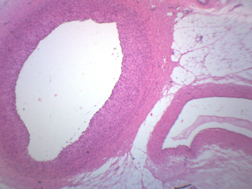 Human Artery & Vein, Prepared Microscope Slide - 75x25mm - Eisco Labs