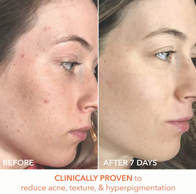 NIB 100%AuthenticDr. Dennis Gross Skincare Mini Alpha Universal Daily Peel Pads