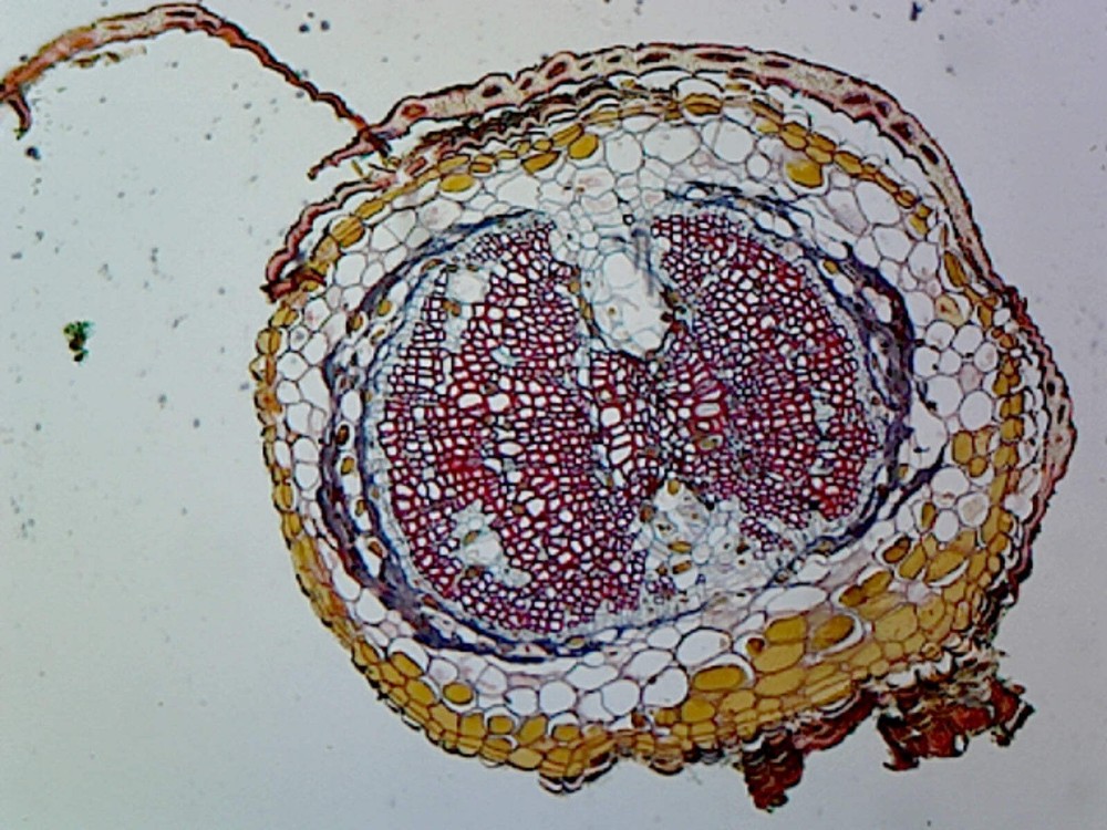 Pine (Gymnosperms) Young Root; Cross Section