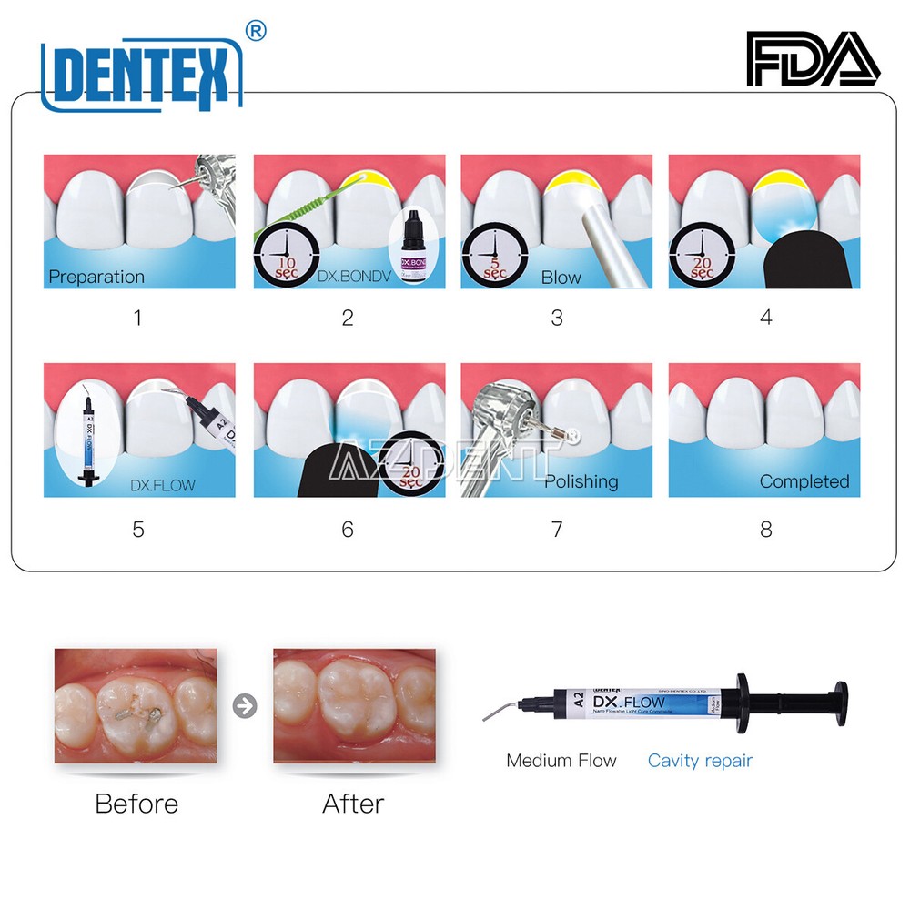 Dental Resin Flowable Light Cure A1/A2/A3 Composite Medium Flow 3g Repair Teeth