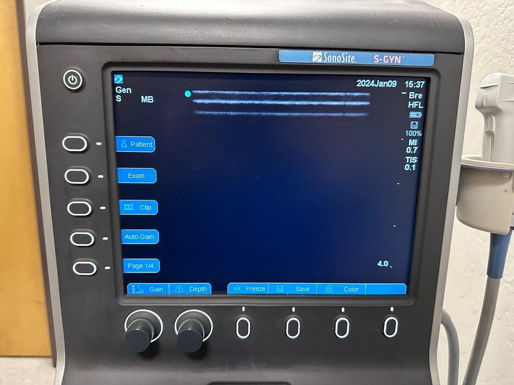 SONOSITE S-GYN ULTRASOUND SYSTEM