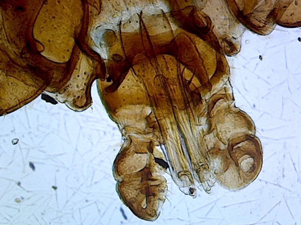 Tick (Arachnid); Whole-mount