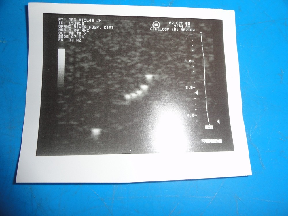 Sonora ARS AT5L40 / ATL 5.0 HRS Linear Array Replacement Transducer ~ 8935