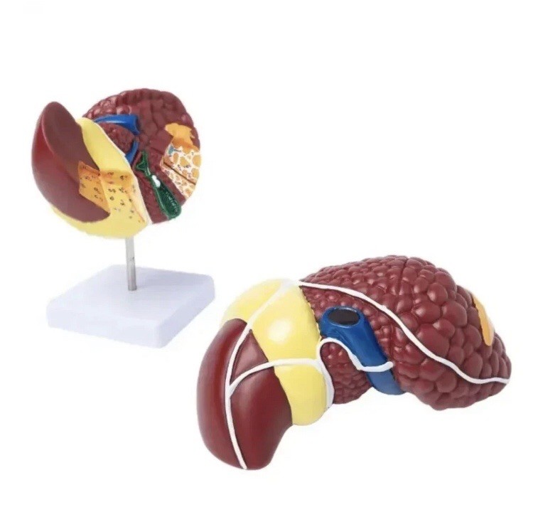 Pathological Liver Anatomical Model 1:1 Human Liver Model Anatomy Display Study
