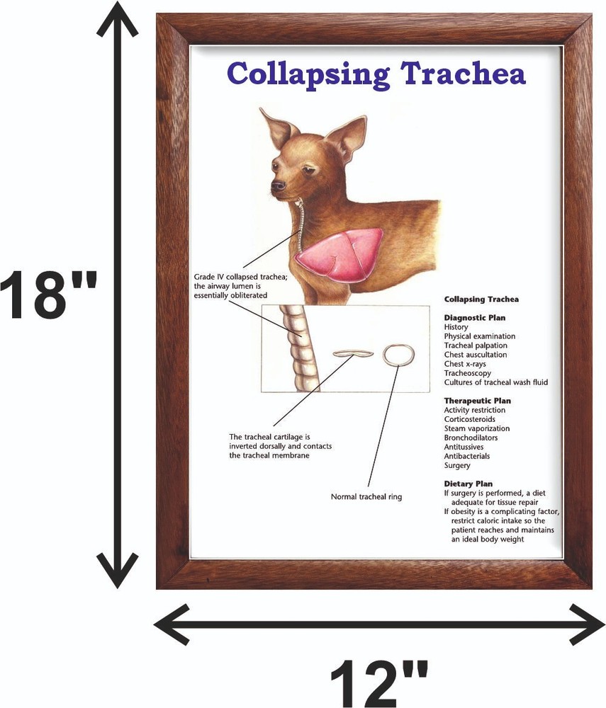 Collapsing Trachea Chart 12x18 inches