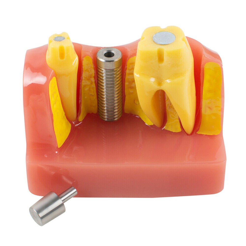 Dental Implant Analysis Crown Bridge Demonstration Teeth Tooth Model Typodont
