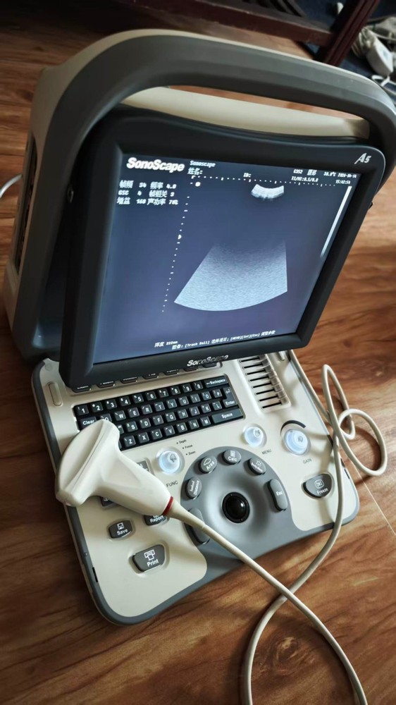 SonoScape A5 Portable Ultrasound