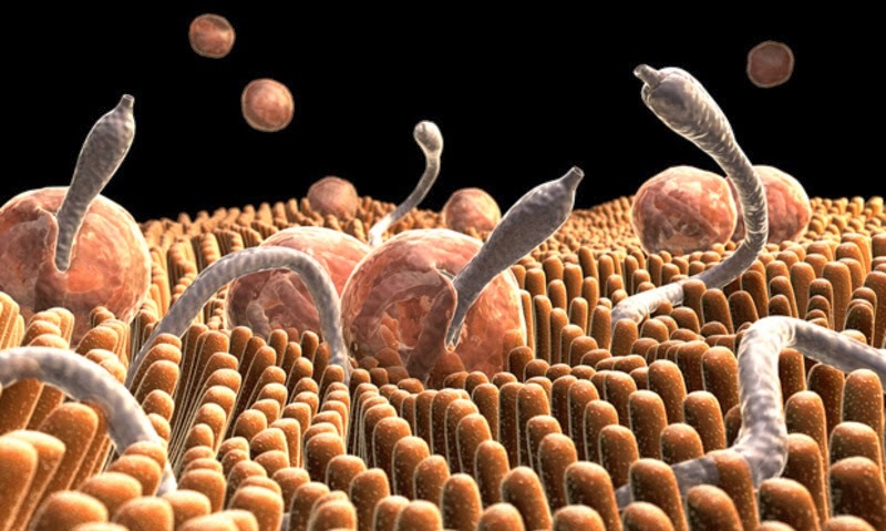 Fungaway - ANTI-PARASITE Complex - The proper cleansing protocol - 3B