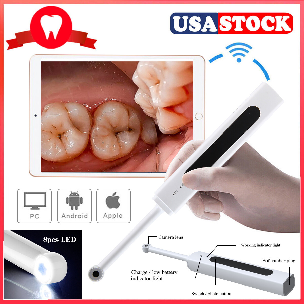 Dental USB Intraoral Camera Oral Endoscope Digital Imaging Intra Oral images