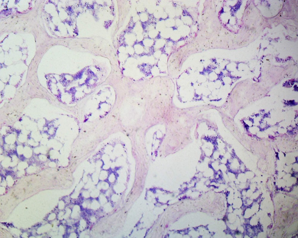 Spongy Bone, Mammalian; Section