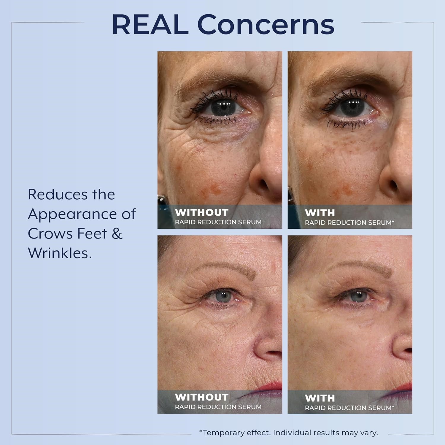 Plexaderm Rapid Reduction Eye Serum - Visibly Reduces Under-Eye Bags, Wrinkles🔥