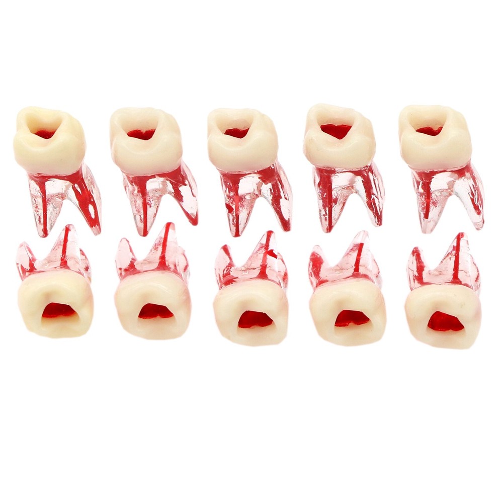 Dental Molar Endo Root Canal Study Model RCT/MTA Practice Block Pulp Cavity