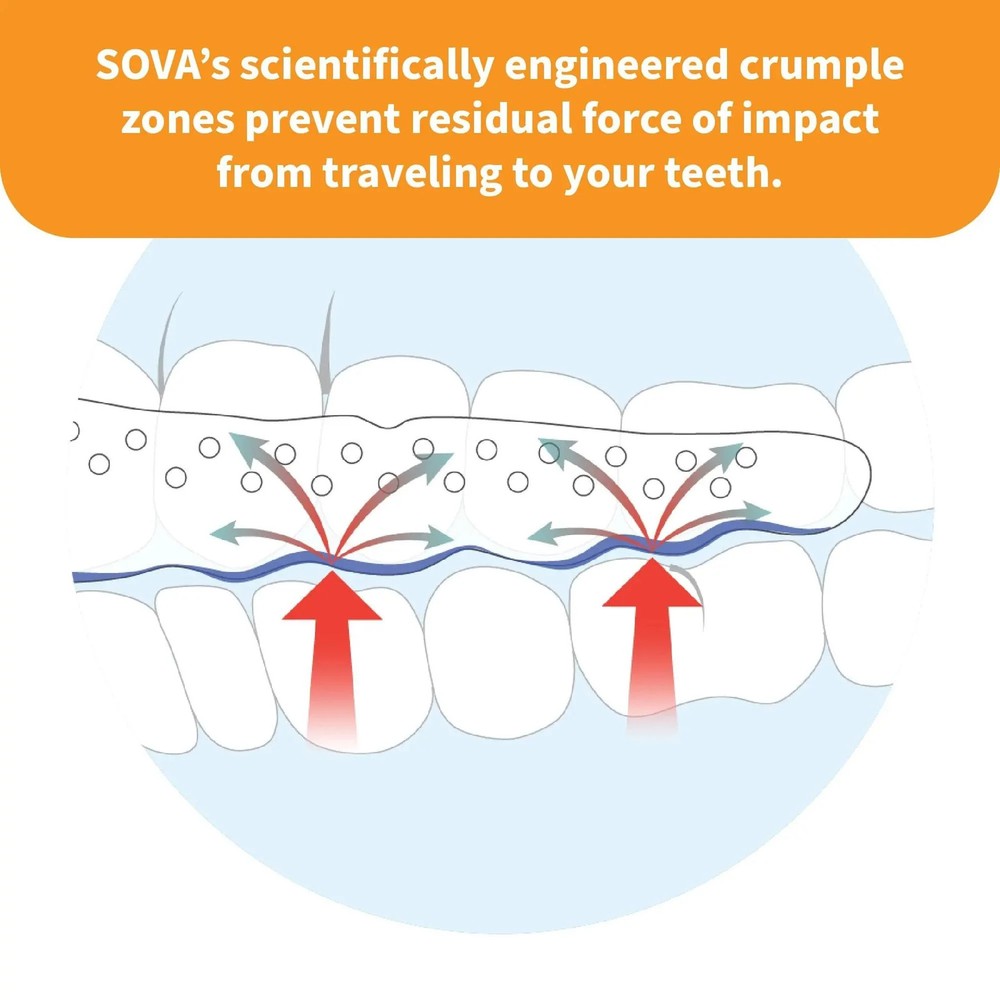 SOVA Junior Mouthguard with Case - Purple Punch