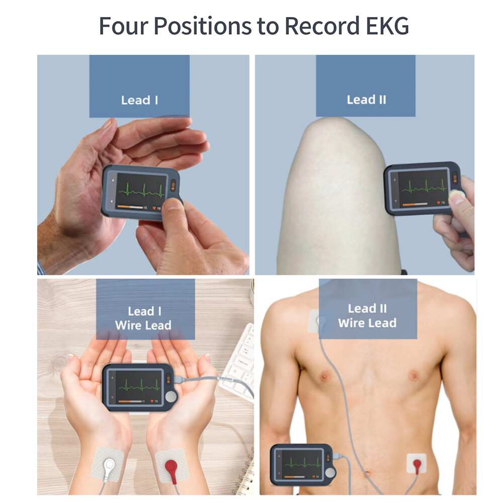Touch Screen EKG Monitor Heart Monitor with ECG Cable AI-ECG Analysis via App