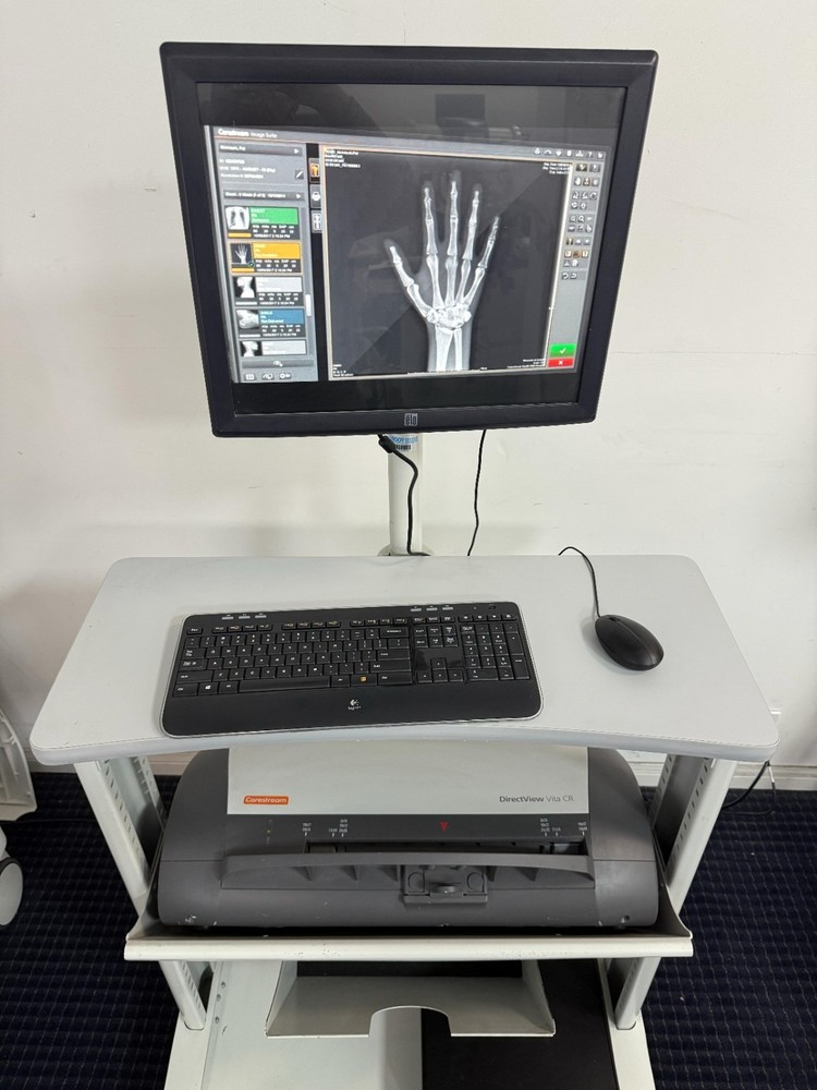 Direct view Vita CR  carestream Digital reader