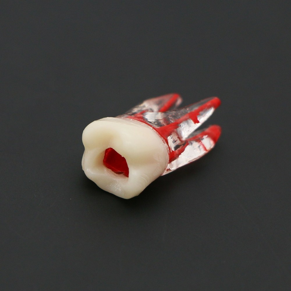 Dental Molar Endo Root Canal Study Model RCT/MTA Practice Block Pulp Cavity