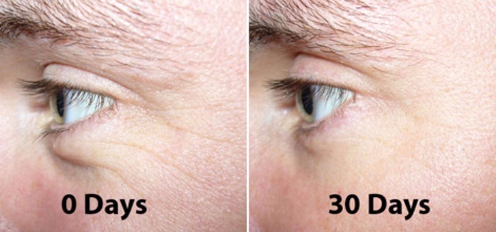 DIY 100% Argireline Copper Peptide Solution Booster + Matrixyl 3000, SNAP-8,