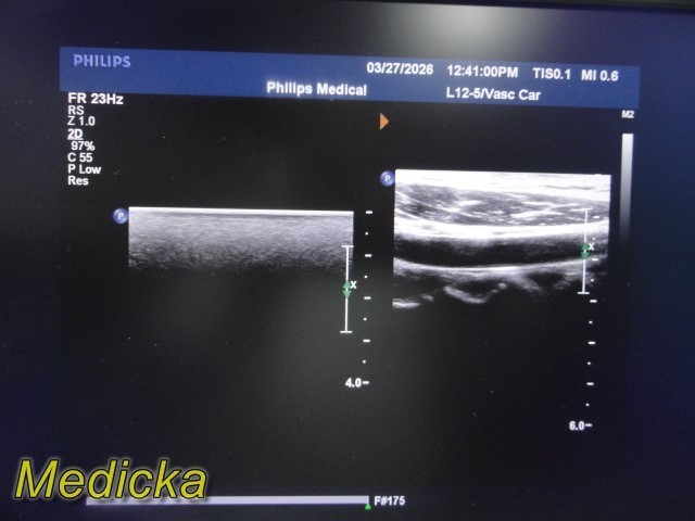Philips L12-5 Linear Array Ultrasound Transducer *TESTED & WORKING* ~ 39679