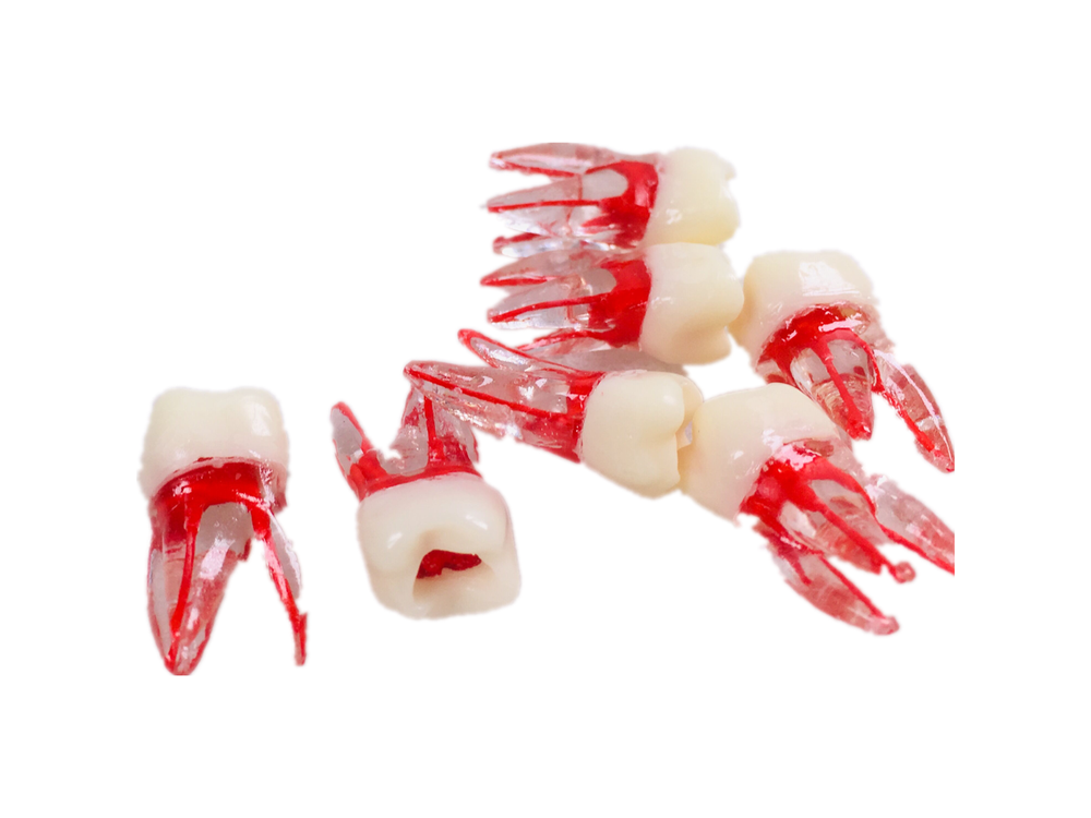Dental Tooth Endo Root Canal Study Model For RCT Practice Blocks Pulp Cavity