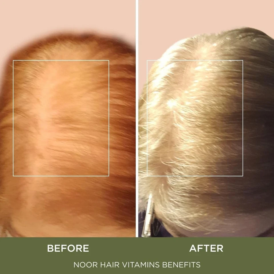NOOR HAIR Healthy Hair Formula, Hair Growth Supplement Supporting Thick Hair