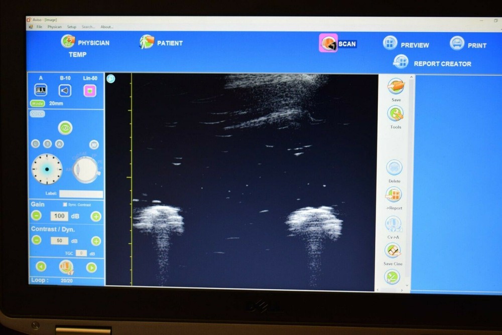 Quantel Aviso Bscan UBM ophthalmic ultrasound